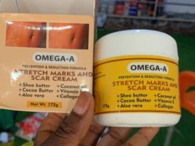 Stretch Mark Remover (Omega A)