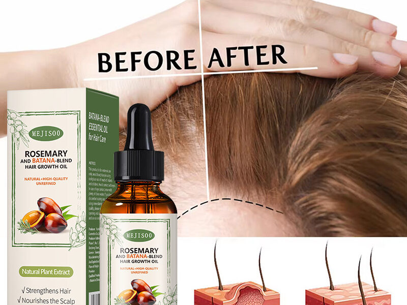 MEJISOO Rosemary & Batana Blend Hair Growth Oil (30ml)